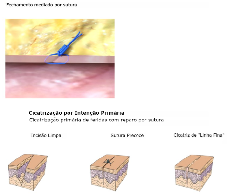 LP ProStyle Overview BR.png